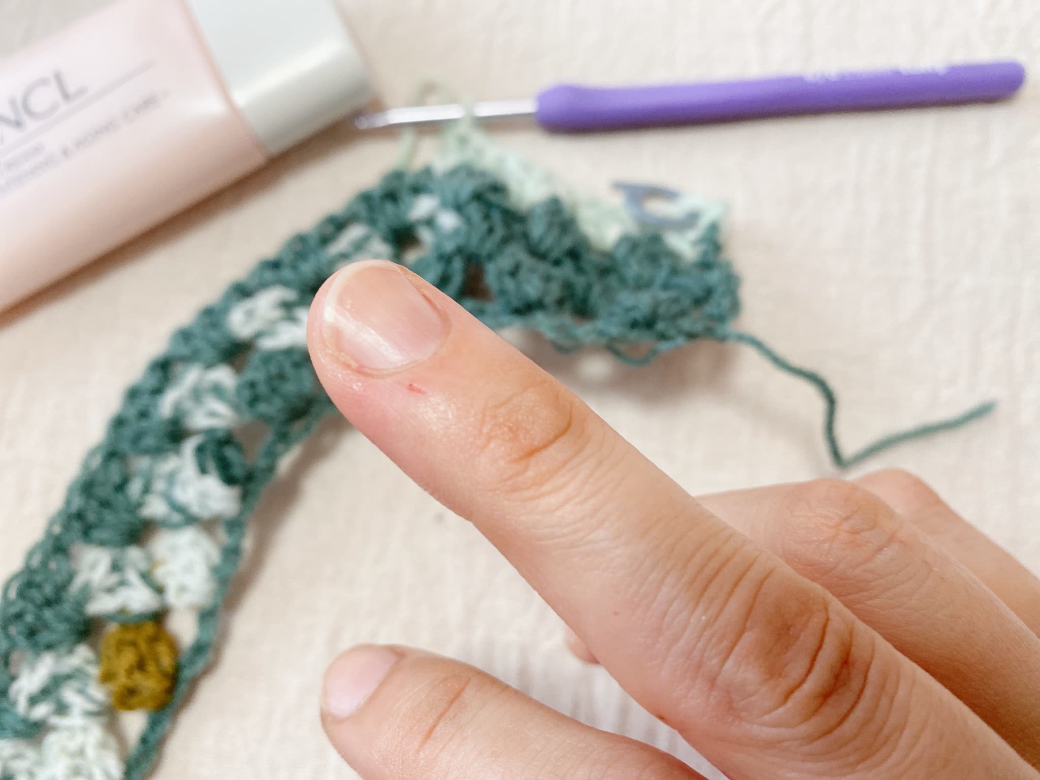 編み物 手荒れ カサカサ